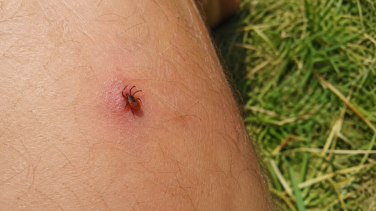 Забыла про дорогие спреи от клещей: наношу это средство на одежду и спокойно гуляю по лесу весь день